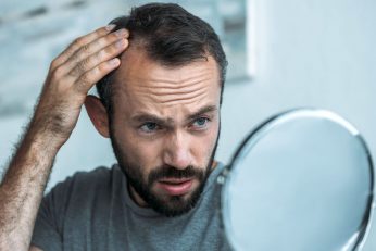homme calvitie précoce